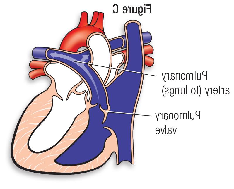 Normal heart figure C